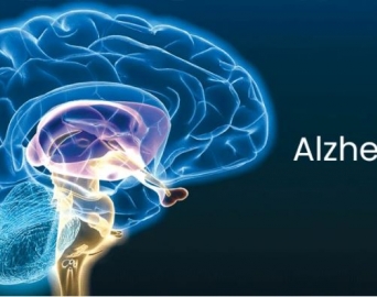 Alzheimer é tema de campanha nesta sexta, 28, no posto Bannwart