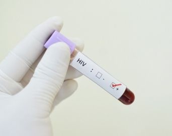 Fique Sabendo: Saúde vai iniciar campanha de testagem de HIV